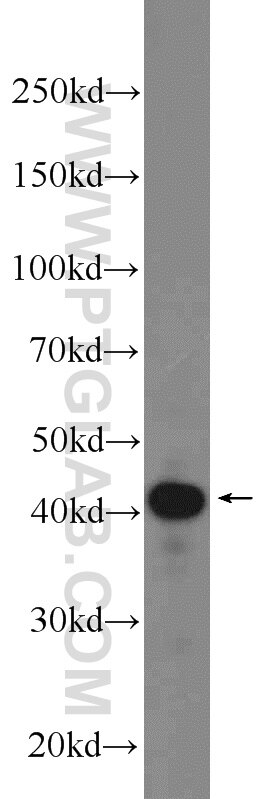 Western Blot (WB) analysis of HEK-293 cells using CCDC104 Polyclonal antibody (24276-1-AP)