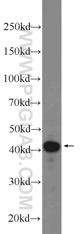 WB analysis of HEK-293 using 24276-1-AP
