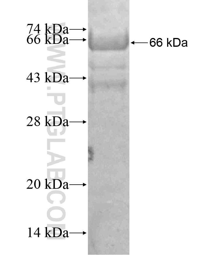 CCDC104 fusion protein Ag17996 SDS-PAGE
