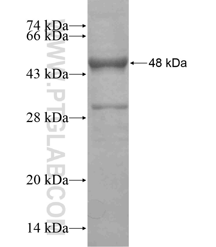 CCDC104 fusion protein Ag18016 SDS-PAGE CCDC104 fusion protein Ag18016 SDS-PAGE