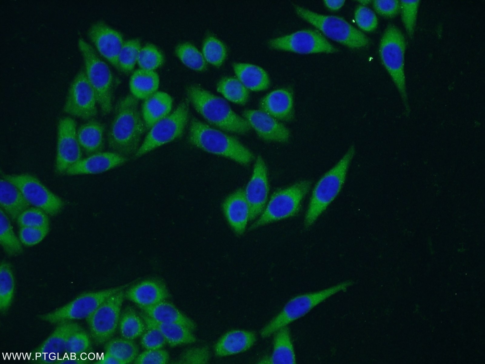 Immunofluorescence (IF) / fluorescent staining of HeLa cells using CCDC105 Polyclonal antibody (24026-1-AP)