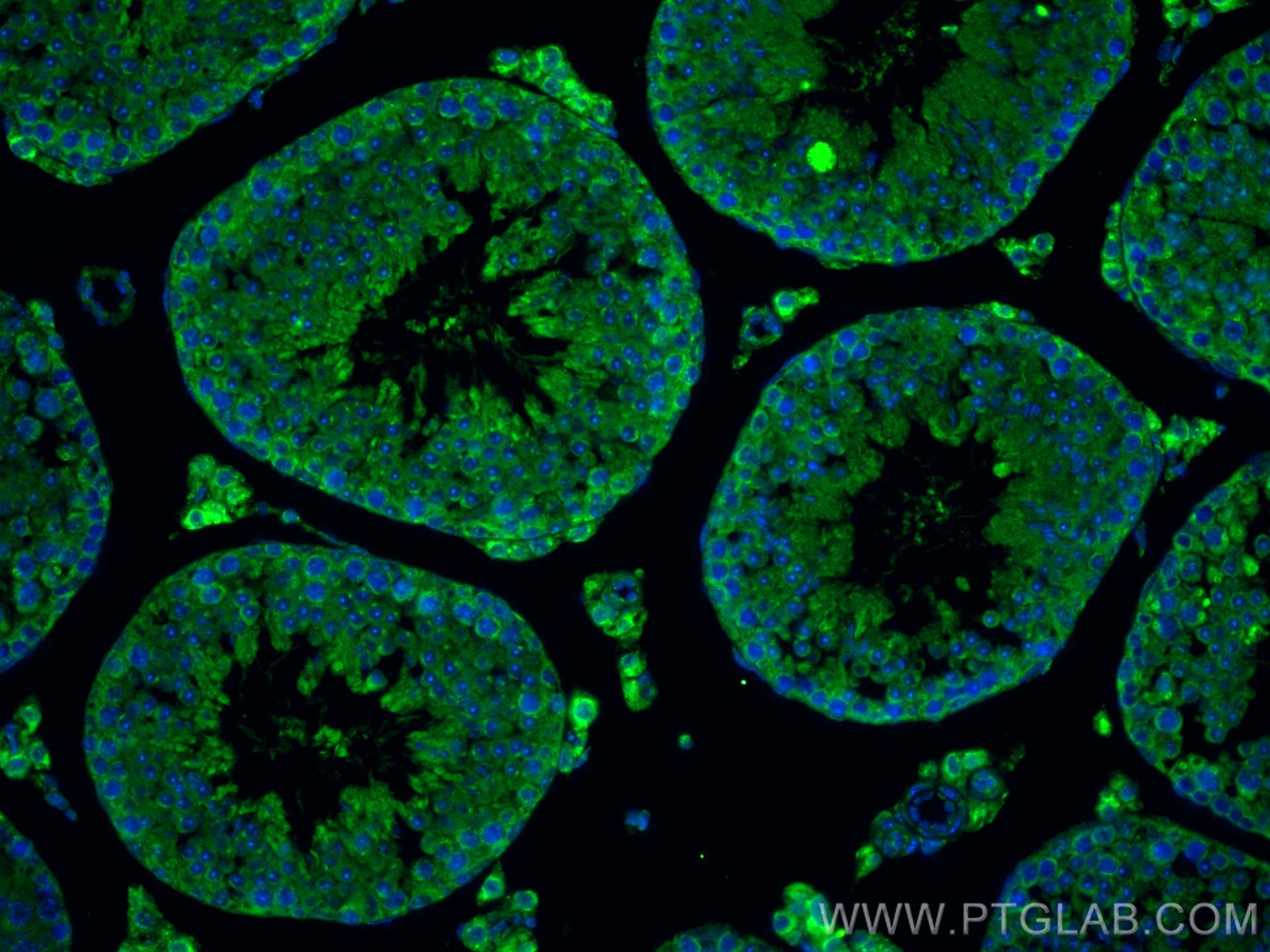 Immunofluorescence (IF) / fluorescent staining of mouse testis tissue using CCDC105 Polyclonal antibody (24026-1-AP)