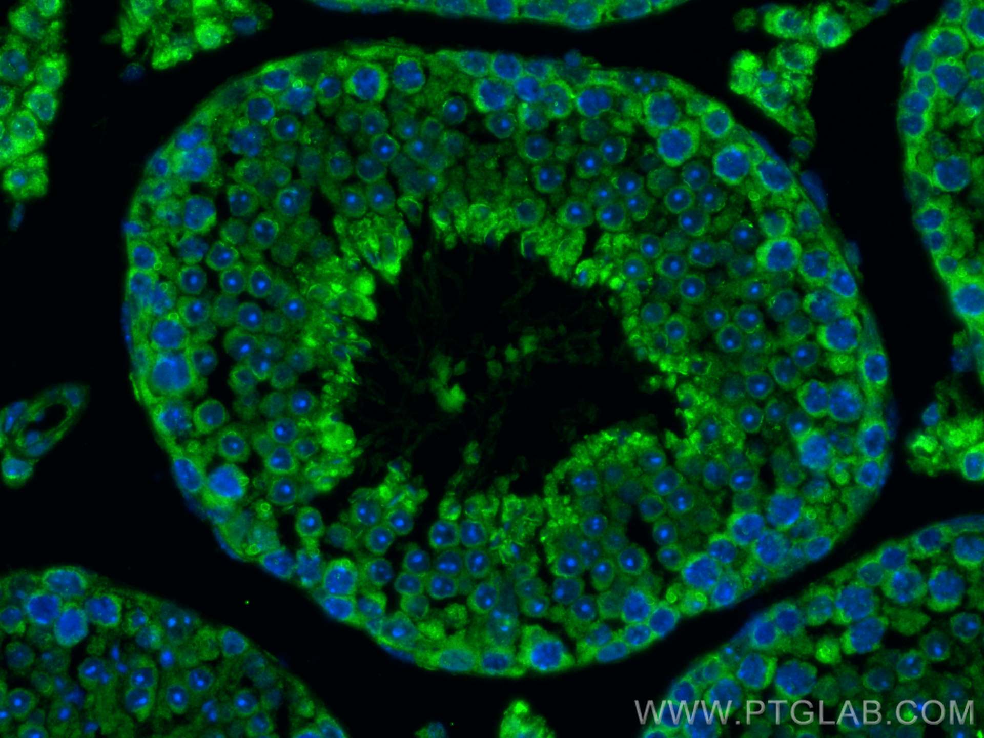 Immunofluorescence (IF) / fluorescent staining of mouse testis tissue using CCDC105 Polyclonal antibody (24026-1-AP)