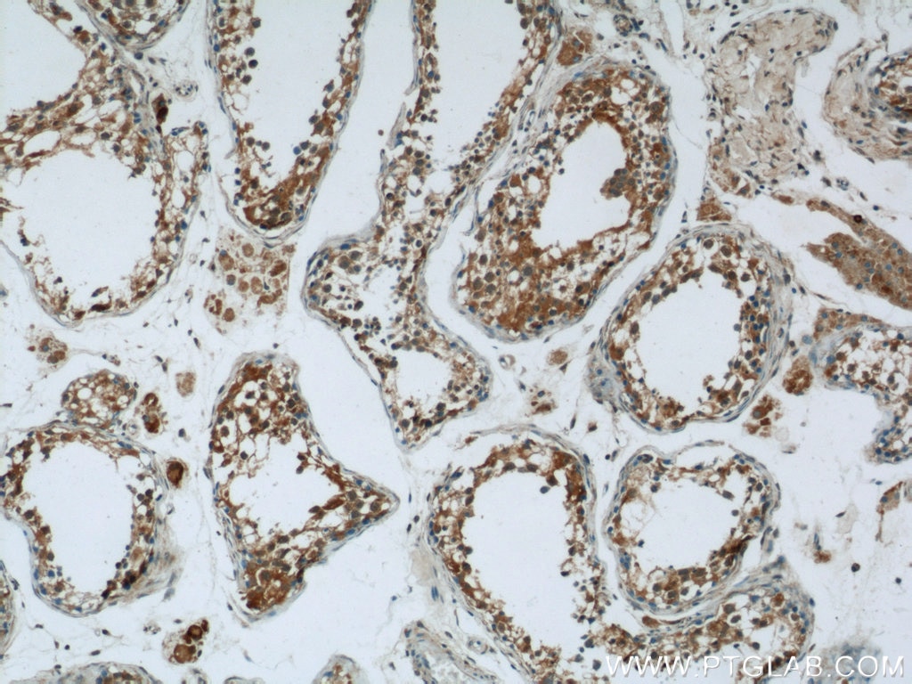 Immunohistochemistry (IHC) staining of human testis tissue using CCDC105 Polyclonal antibody (24026-1-AP)