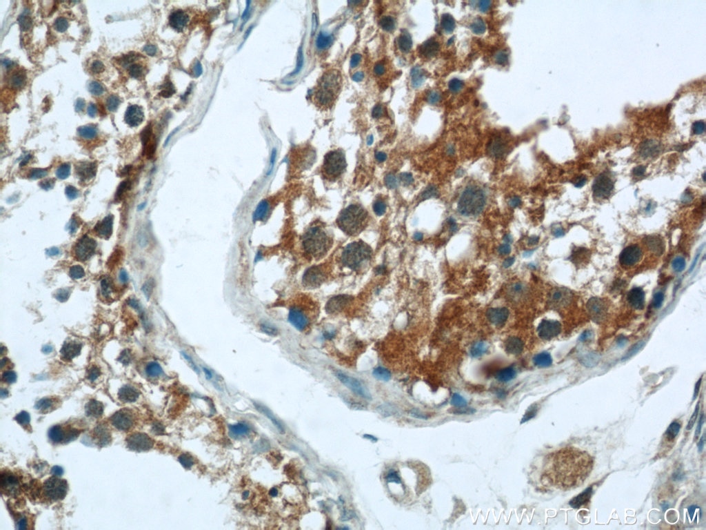 Immunohistochemistry (IHC) staining of human testis tissue using CCDC105 Polyclonal antibody (24026-1-AP)