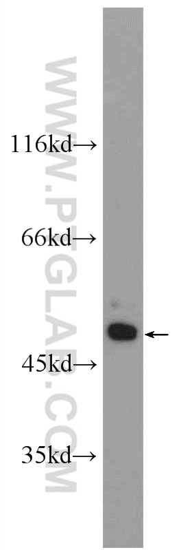Western Blot (WB) analysis of HeLa cells using CCDC105 Polyclonal antibody (24026-1-AP)