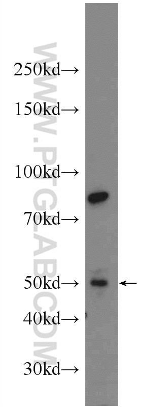 Western Blot (WB) analysis of SH-SY5Y cells using CCDC105 Polyclonal antibody (24026-1-AP)
