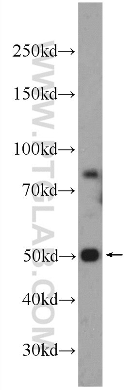 Western Blot (WB) analysis of DU 145 cells using CCDC105 Polyclonal antibody (24026-1-AP)