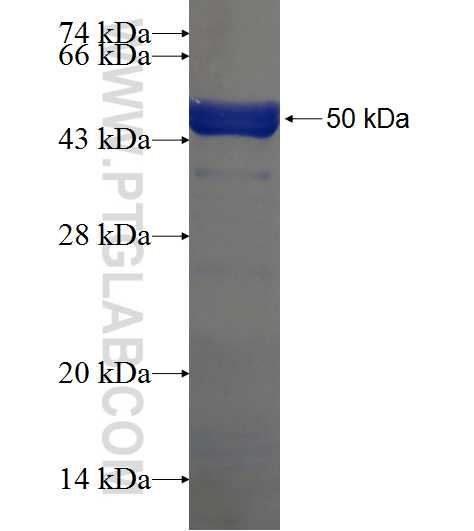 CCDC105 fusion protein Ag21208 SDS-PAGE