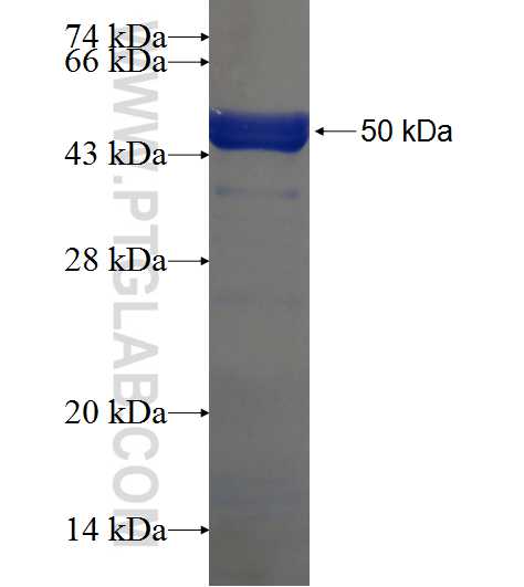 CCDC105 fusion protein Ag21208 SDS-PAGE
