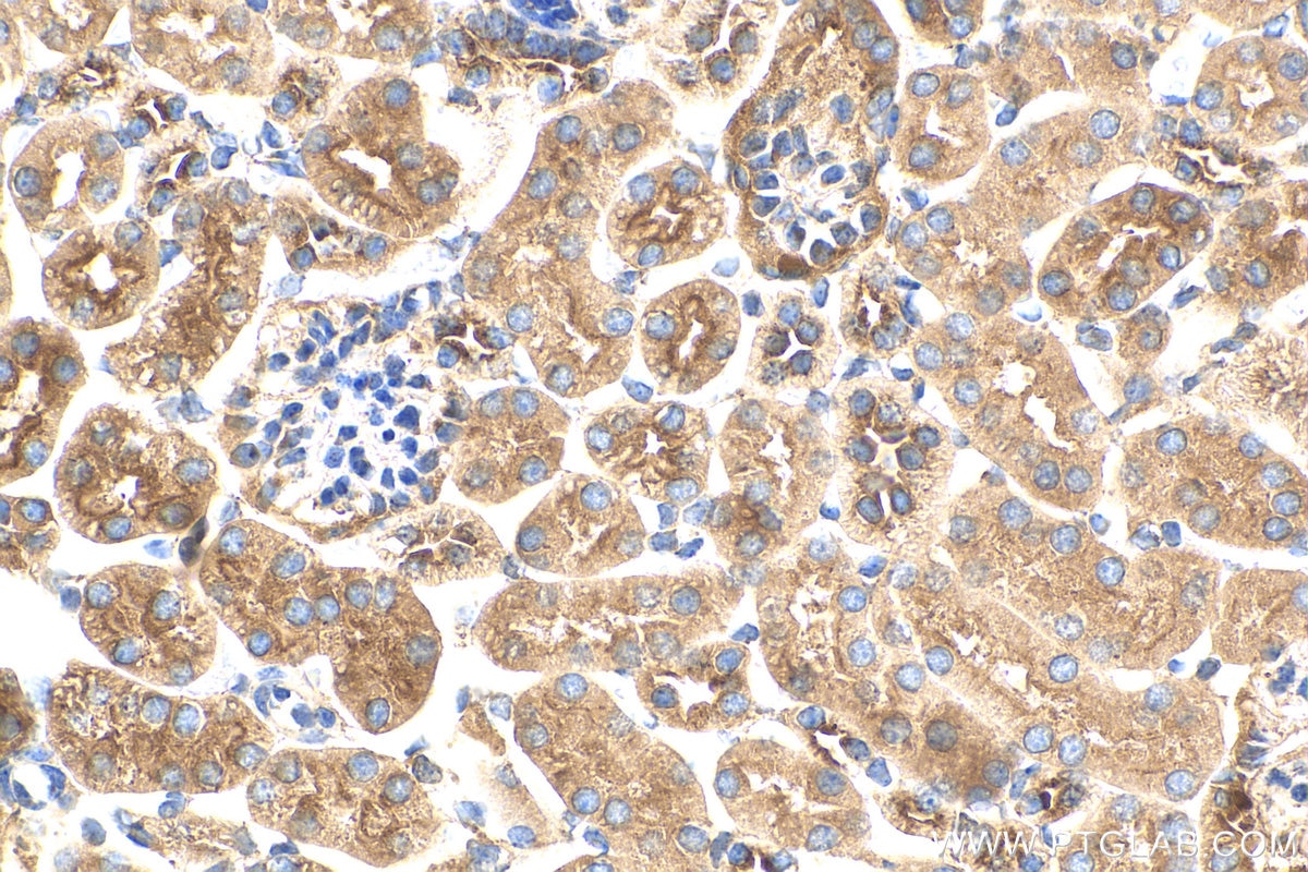 Immunohistochemistry (IHC) staining of mouse kidney tissue using MCU/CCDC109A Polyclonal antibody (26312-1-AP)