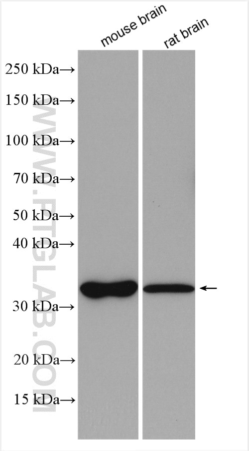 Western Blot (WB) analysis of various lysates using MCU/CCDC109A Polyclonal antibody (26312-1-AP)