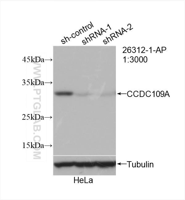 Western Blot (WB) analysis of HeLa cells using MCU/CCDC109A Polyclonal antibody (26312-1-AP)