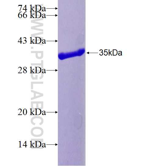 CCDC109A fusion protein Ag24733 SDS-PAGE