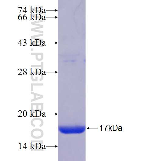 CCDC109A fusion protein Ag24741 SDS-PAGE
