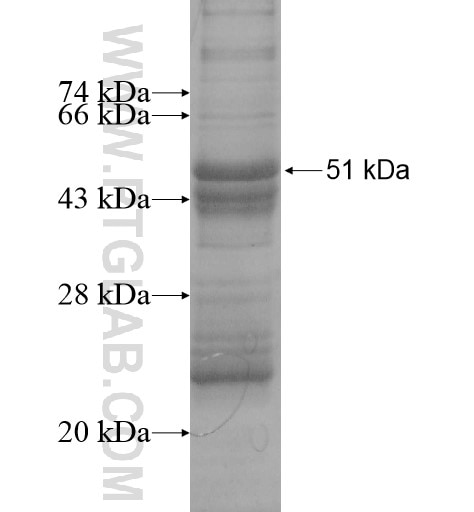 CCDC109B fusion protein Ag14225 SDS-PAGE