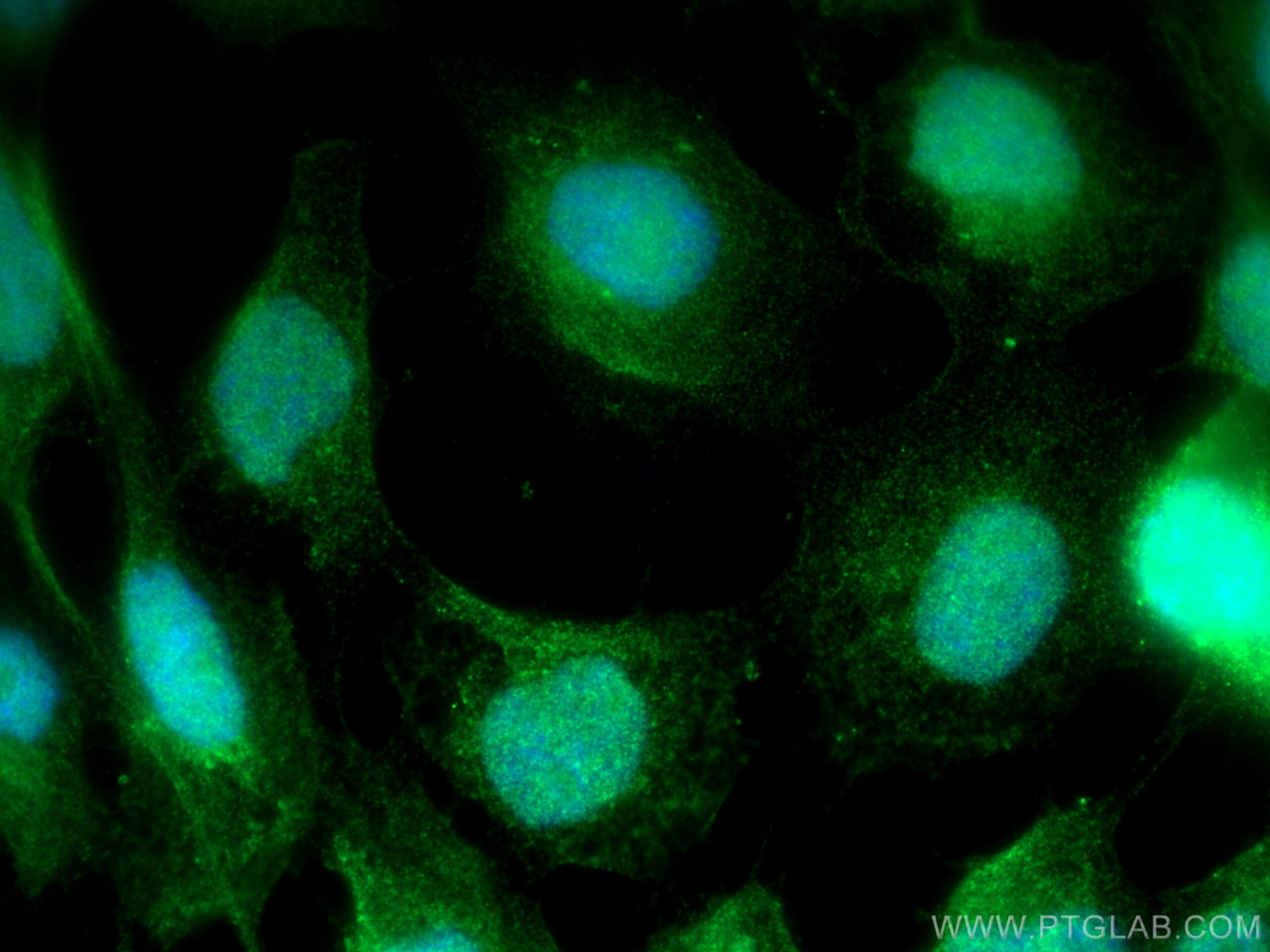 Immunofluorescence (IF) / fluorescent staining of A431 cells using CCDC111/PRIMPOL Polyclonal antibody (29824-1-AP)