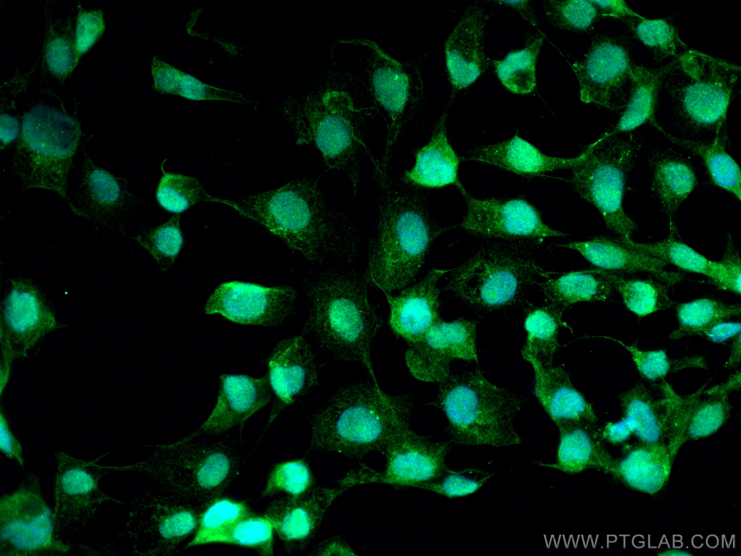 Immunofluorescence (IF) / fluorescent staining of A431 cells using CCDC111/PRIMPOL Polyclonal antibody (29824-1-AP)