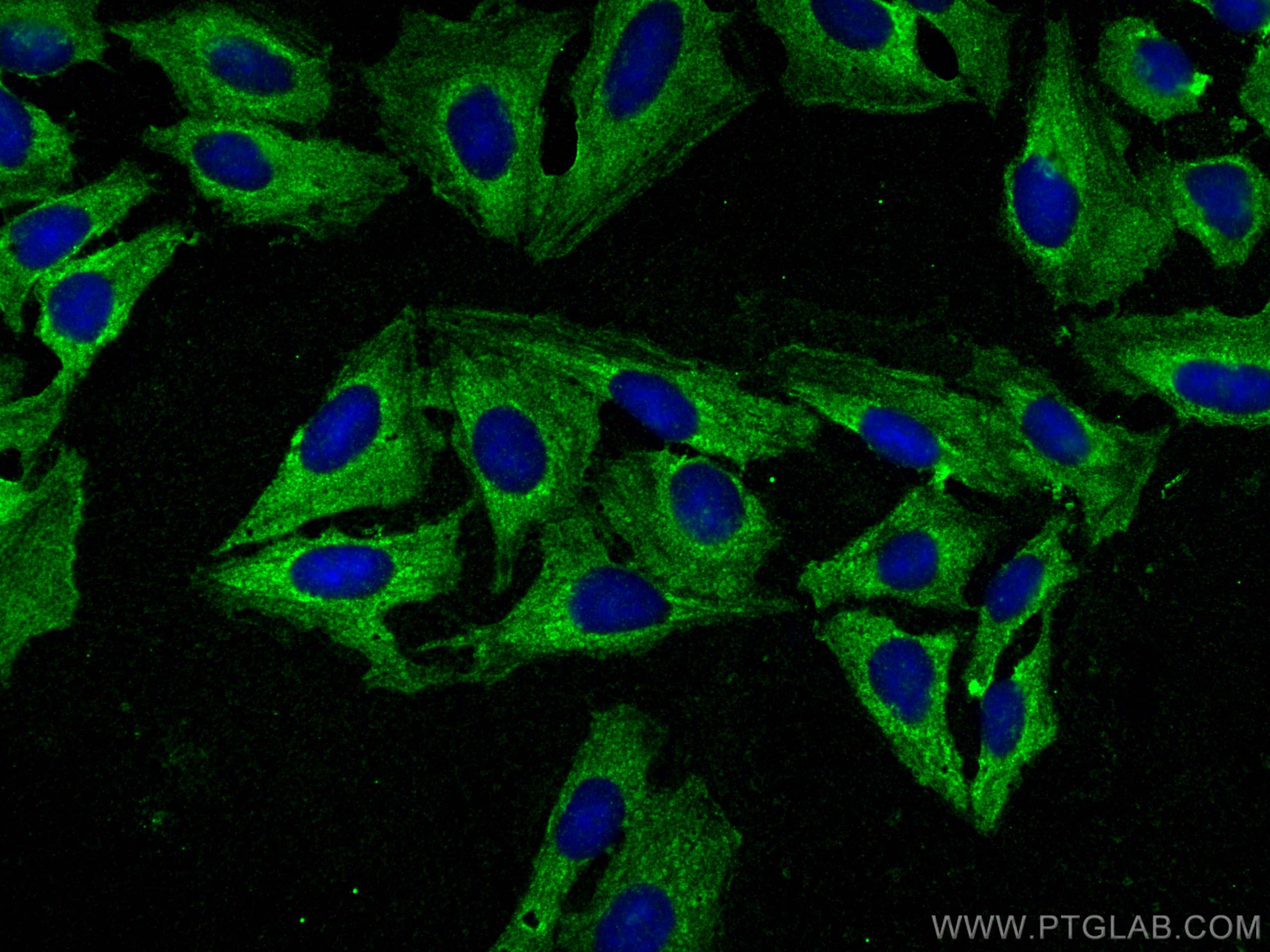 Immunofluorescence (IF) / fluorescent staining of U2OS cells using CCDC111/PRIMPOL Polyclonal antibody (29824-1-AP)