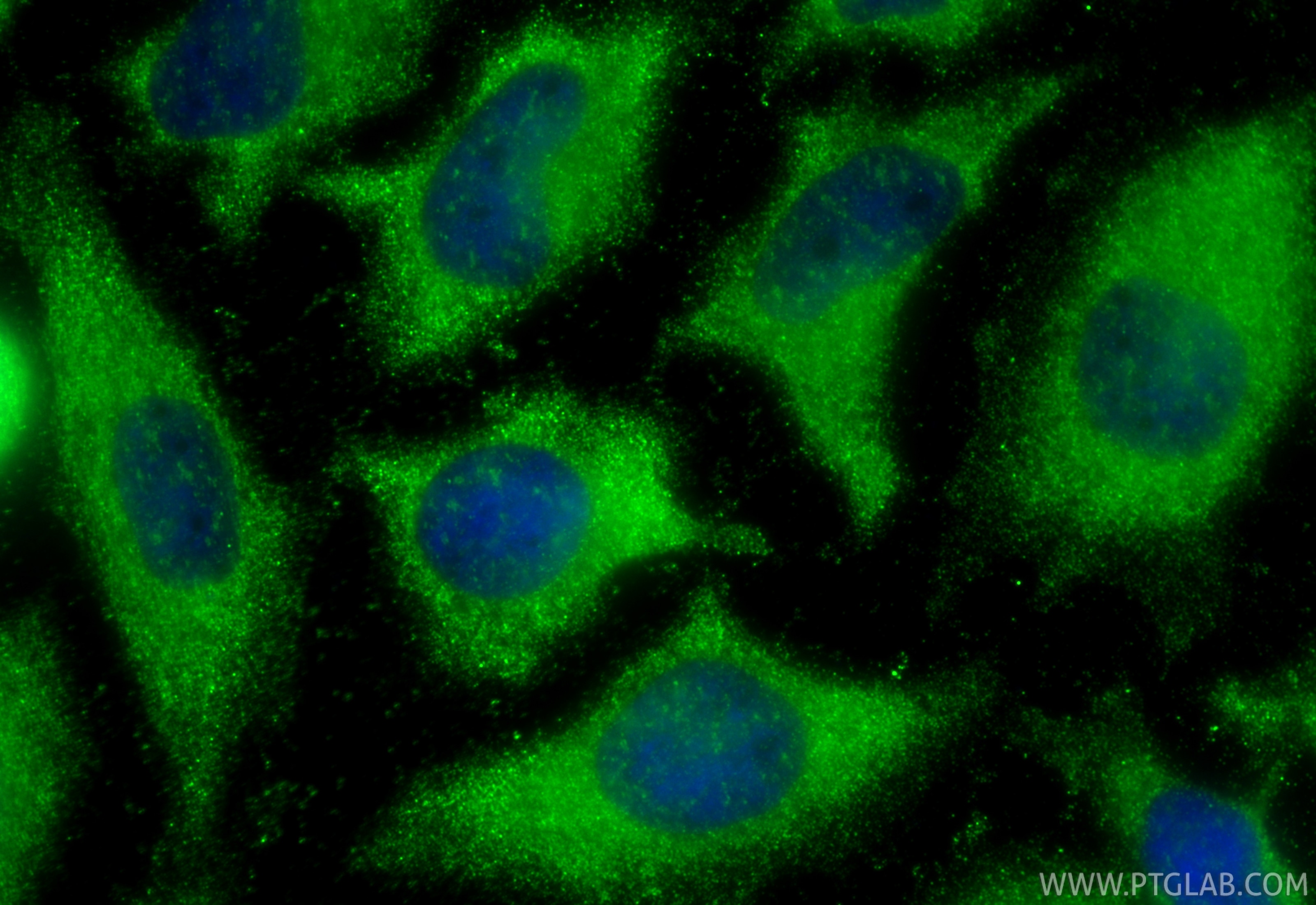 IF Staining of HeLa using 29824-1-AP Immunofluorescence (IF) / fluorescent staining of HeLa cells using CCDC111/PRIMPOL Polyclonal antibody (29824-1-AP)