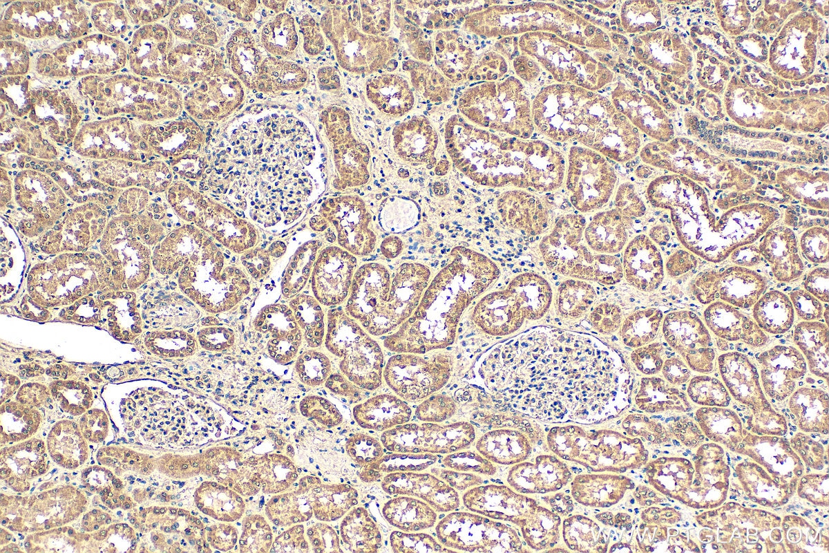 Immunohistochemistry (IHC) staining of human kidney tissue using CCDC111/PRIMPOL Polyclonal antibody (29824-1-AP)