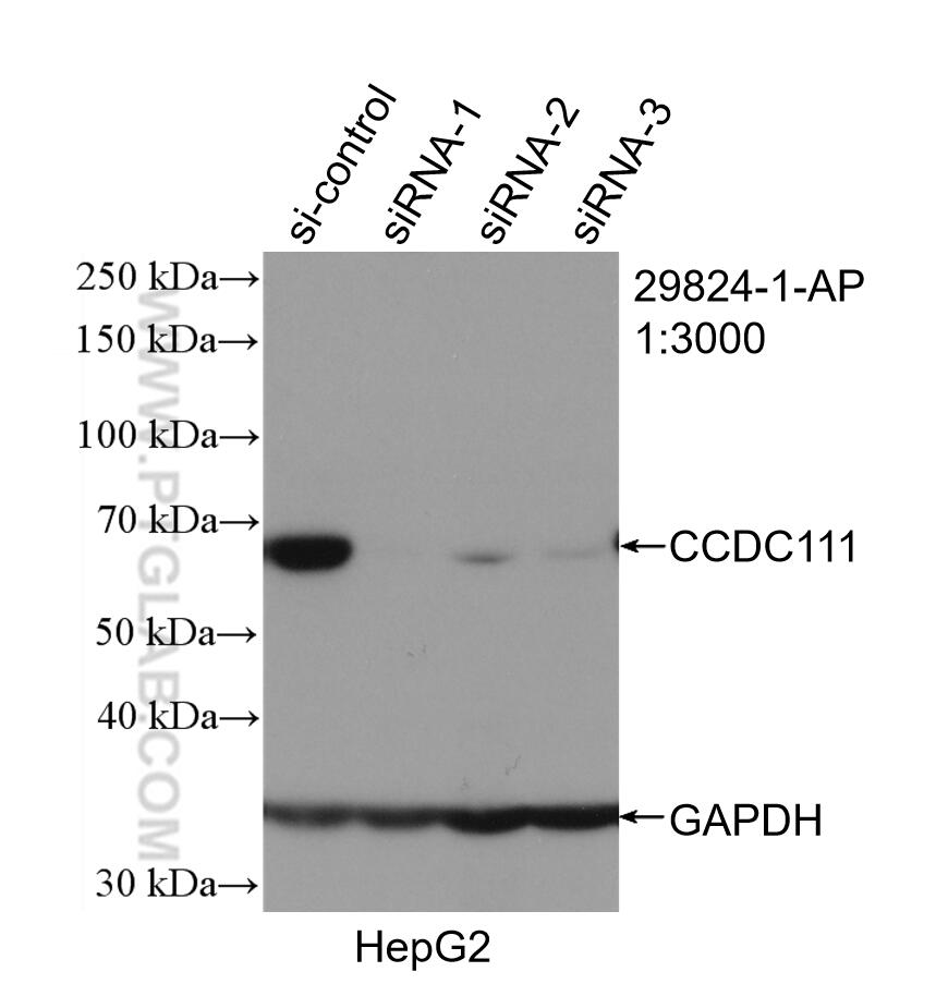 Western Blot (WB) analysis of HepG2 cells using CCDC111/PRIMPOL Polyclonal antibody (29824-1-AP)