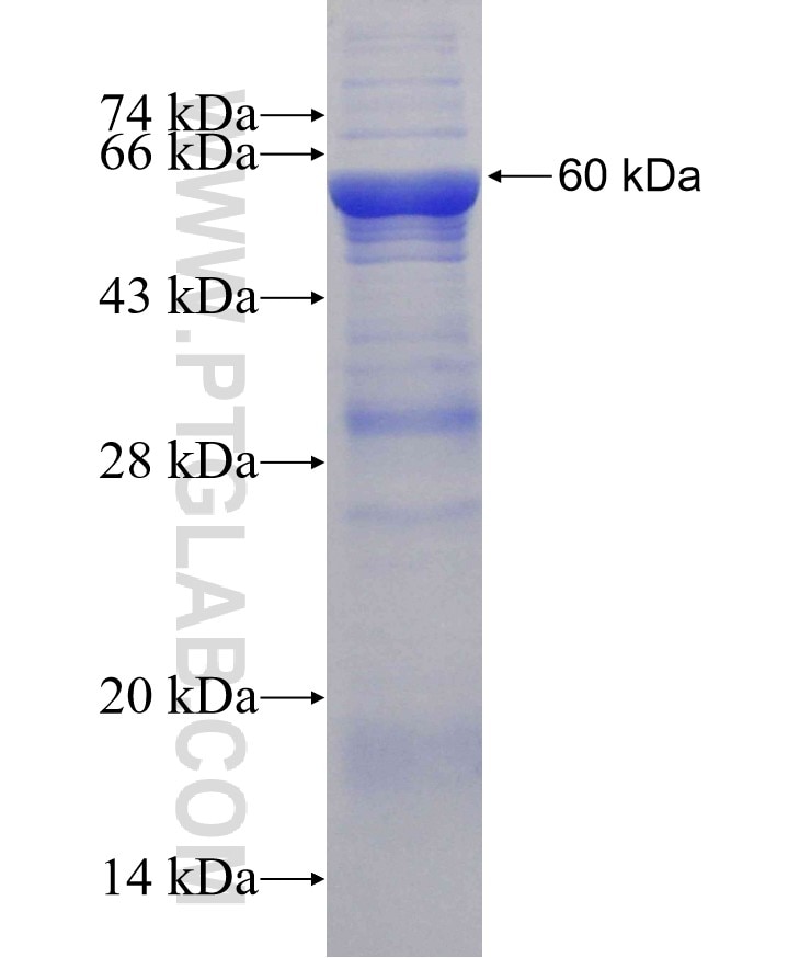 CCDC111 fusion protein Ag31478 SDS-PAGE