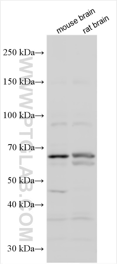 Western Blot (WB) analysis of various lysates using CCDC114 Polyclonal antibody (27211-1-AP)