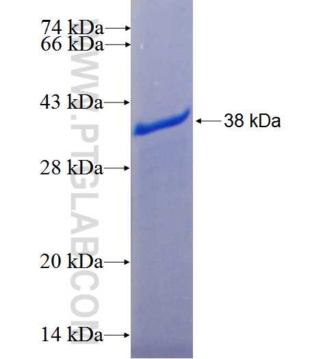 CCDC114 fusion protein Ag26053 SDS-PAGE