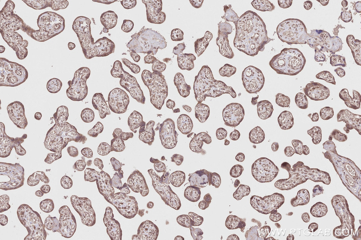 IHC staining of human placenta using 20636-1-AP Immunohistochemistry (IHC) staining of human placenta tissue using CCDC115 Polyclonal antibody (20636-1-AP)