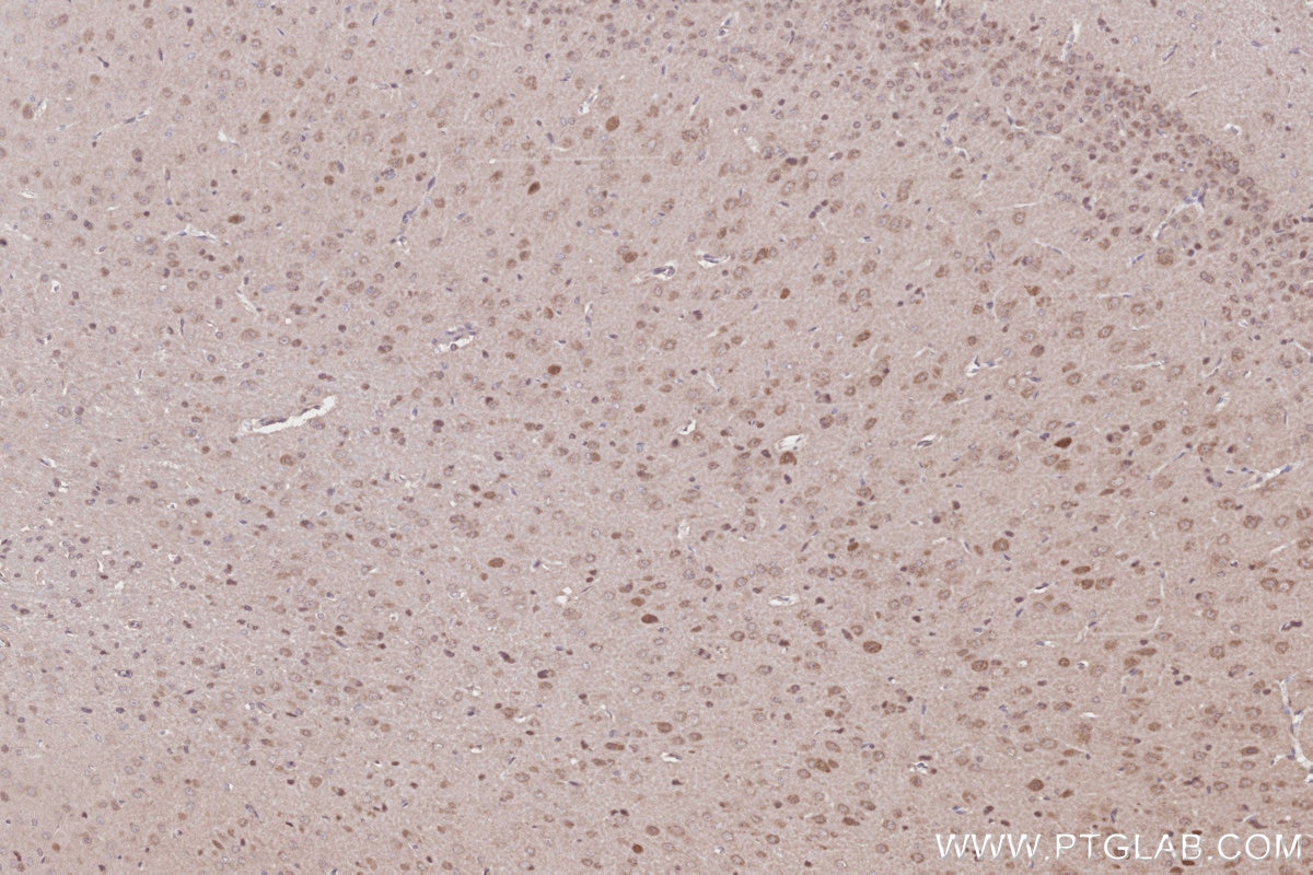 IHC staining of rat brain using 20636-1-AP Immunohistochemistry (IHC) staining of rat brain tissue using CCDC115 Polyclonal antibody (20636-1-AP)