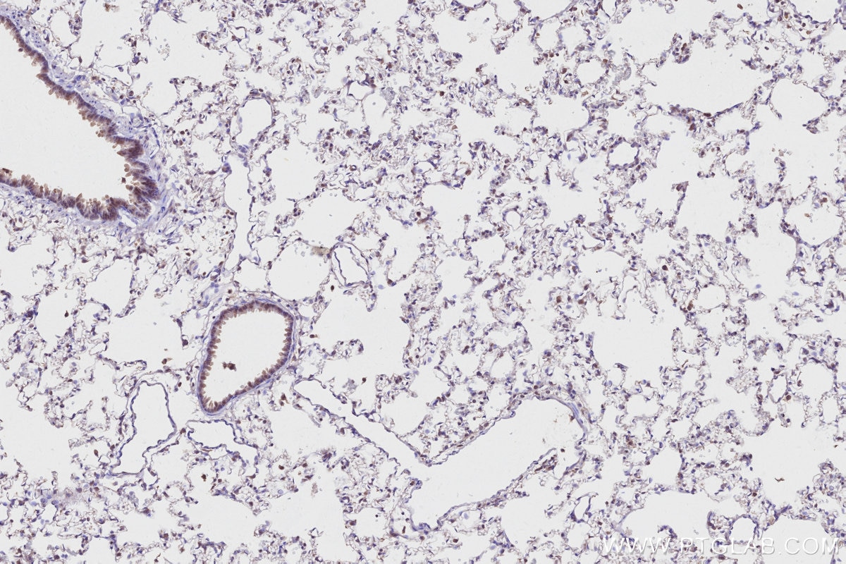 IHC staining of rat lung using 20636-1-AP Immunohistochemistry (IHC) staining of rat lung tissue using CCDC115 Polyclonal antibody (20636-1-AP)