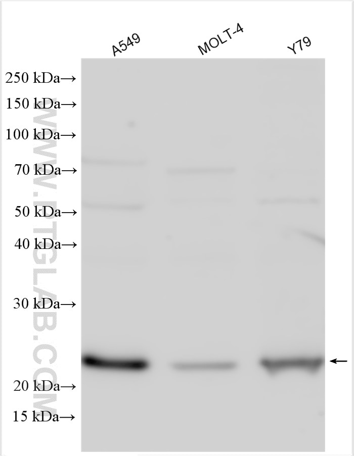 Western Blot (WB) analysis of various lysates using CCDC115 Polyclonal antibody (20636-1-AP)