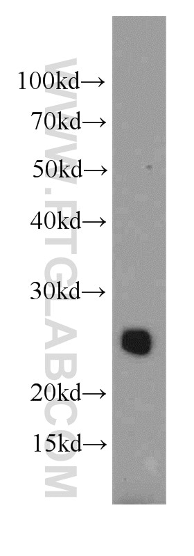 Western Blot (WB) analysis of mouse brain tissue using CCDC115 Polyclonal antibody (20636-1-AP)