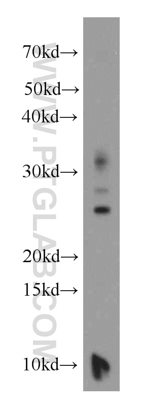 Western Blot (WB) analysis of mouse brain tissue using CCDC115 Polyclonal antibody (20636-1-AP)