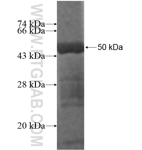 CCDC115 fusion protein Ag14677 SDS-PAGE