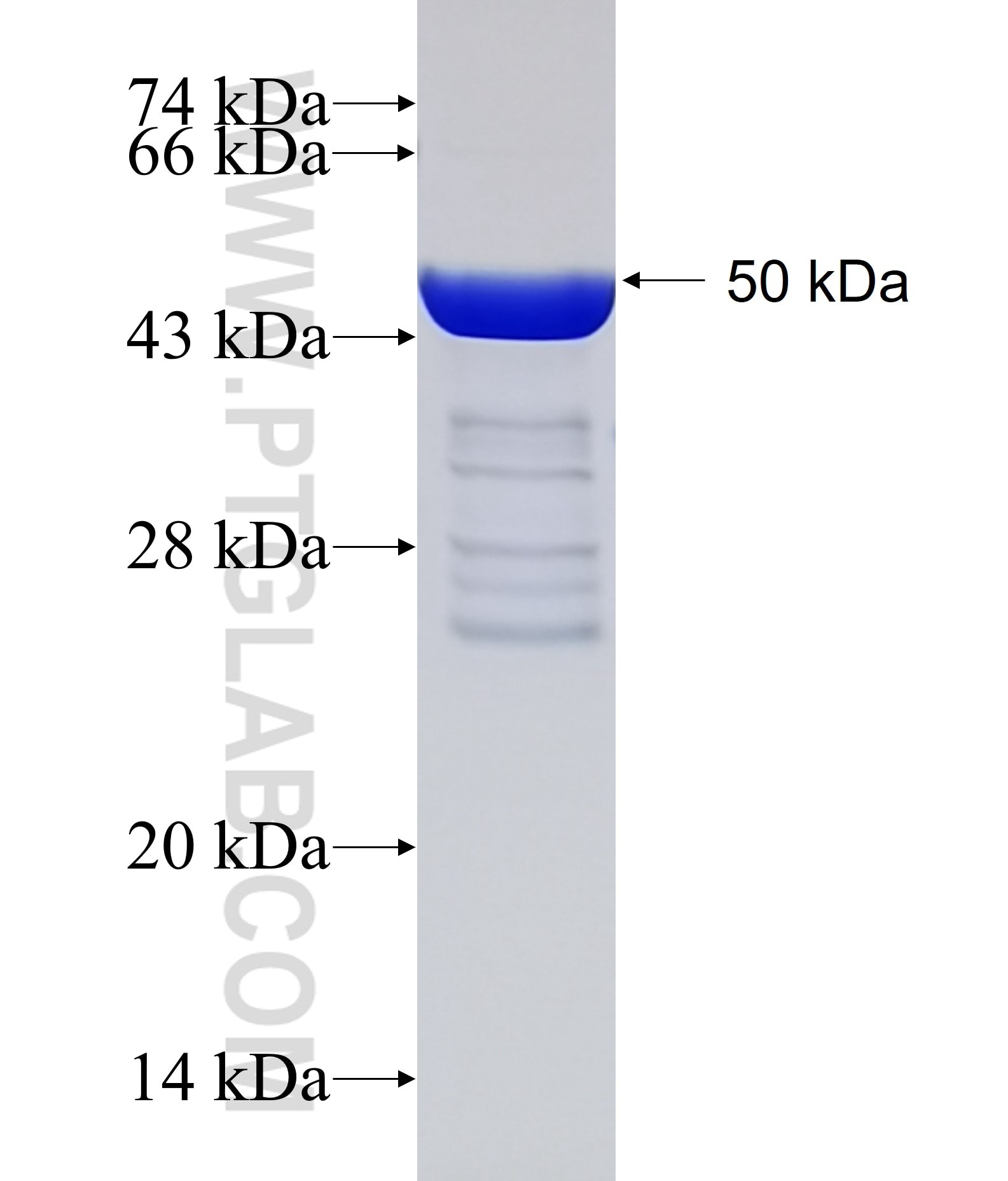 CCDC115 fusion protein Ag14677 SDS-PAGE