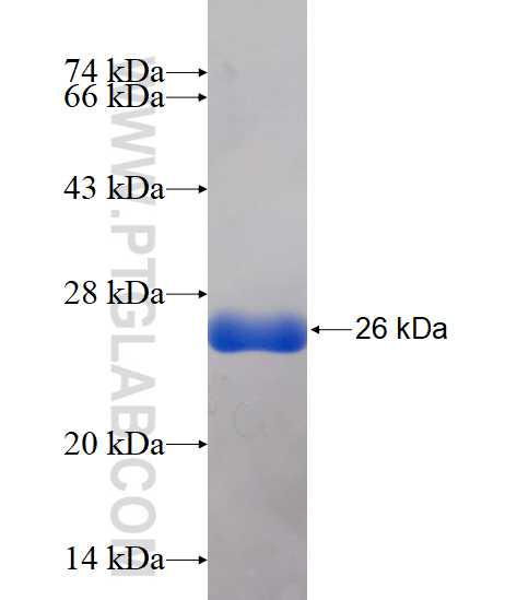 CCDC115 fusion protein Ag14998 SDS-PAGE