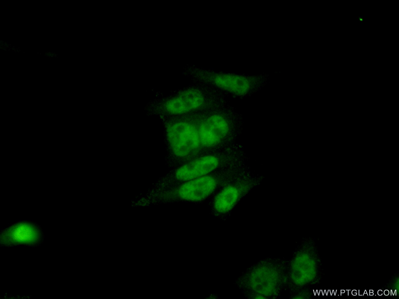 Immunofluorescence (IF) / fluorescent staining of HeLa cells using CCDC12 Polyclonal antibody (25138-1-AP)