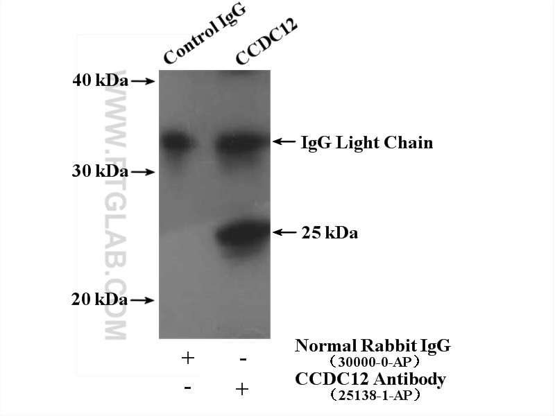 Immunoprecipitation (IP) experiment of HeLa cells using CCDC12 Polyclonal antibody (25138-1-AP)