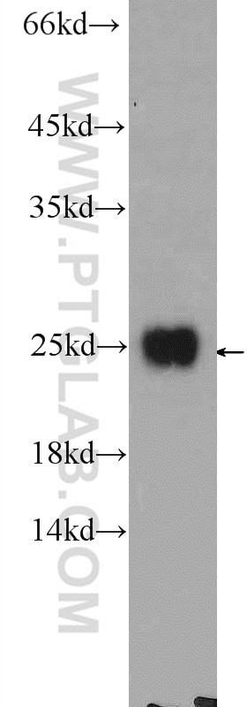 Western Blot (WB) analysis of HeLa cells using CCDC12 Polyclonal antibody (25138-1-AP)