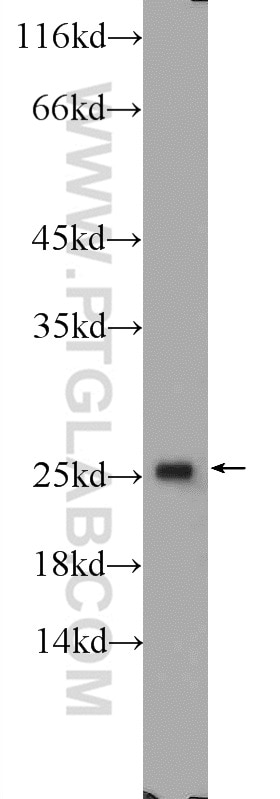 Western Blot (WB) analysis of Raji cells using CCDC12 Polyclonal antibody (25138-1-AP)