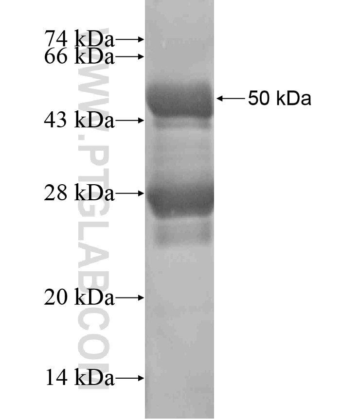 CCDC12 fusion protein Ag18223 SDS-PAGE