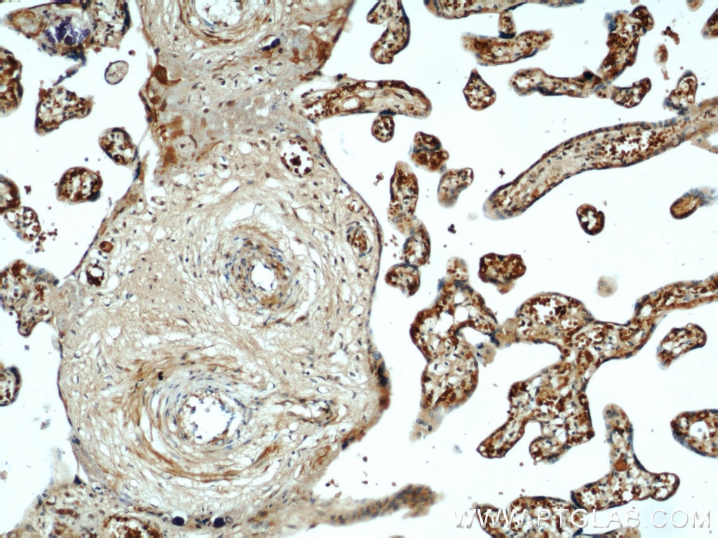 Immunohistochemistry (IHC) staining of human placenta tissue using CCDC120 Polyclonal antibody (22041-1-AP)