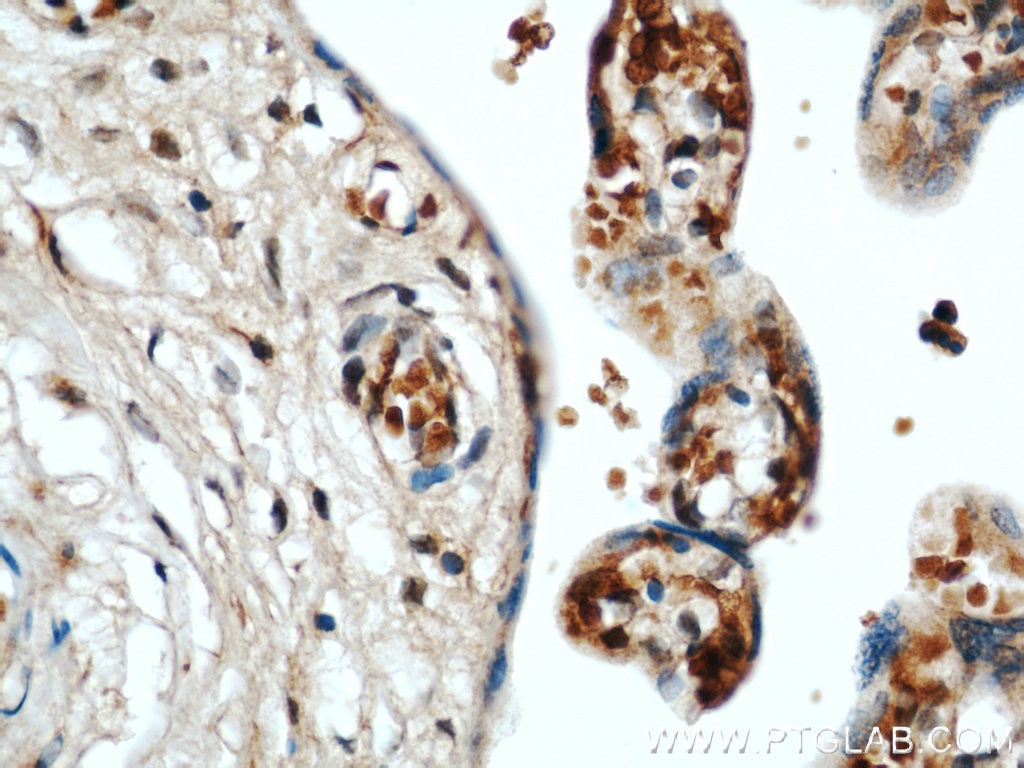 Immunohistochemistry (IHC) staining of human placenta tissue using CCDC120 Polyclonal antibody (22041-1-AP)