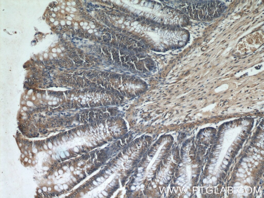 Immunohistochemistry (IHC) staining of human colon tissue using CCDC120 Polyclonal antibody (22041-1-AP)