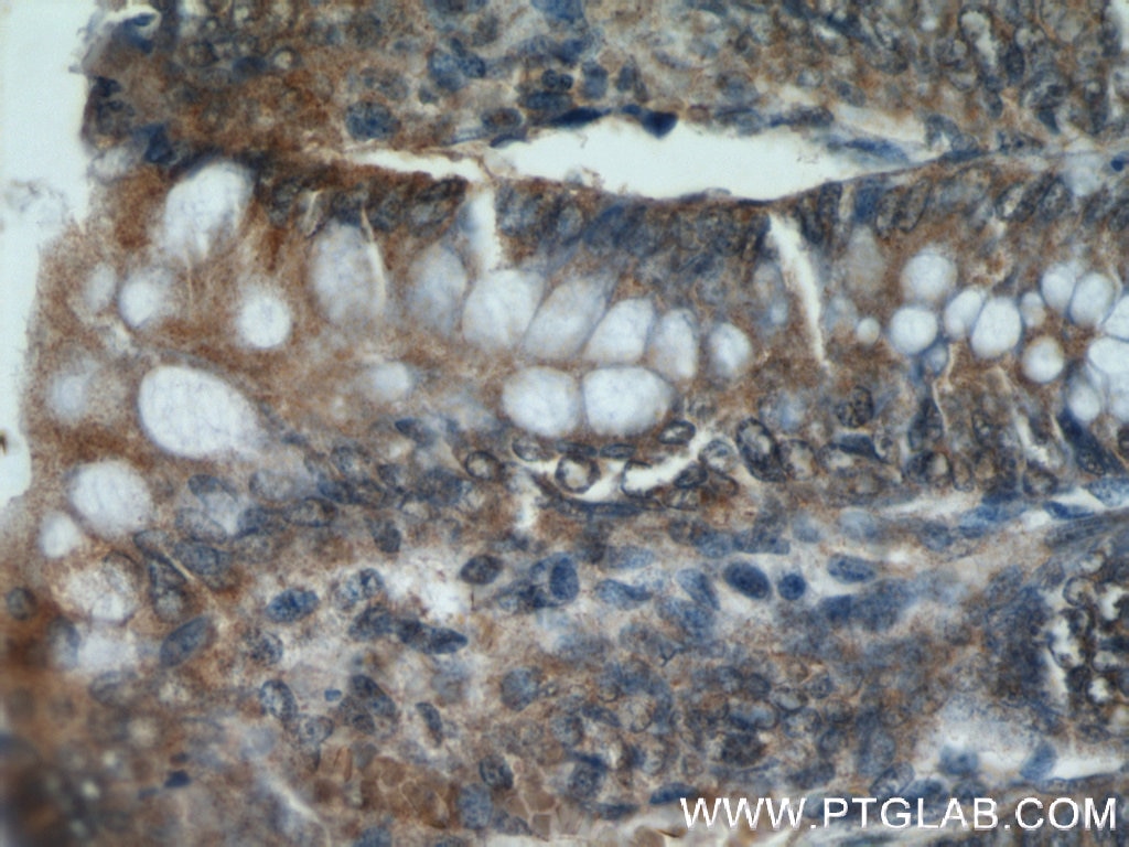 Immunohistochemistry (IHC) staining of human colon tissue using CCDC120 Polyclonal antibody (22041-1-AP)