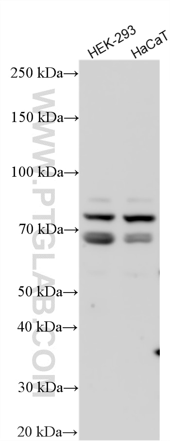 Western Blot (WB) analysis of various lysates using CCDC120 Polyclonal antibody (22041-1-AP)