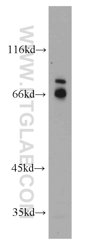 Western Blot (WB) analysis of Jurkat cells using CCDC120 Polyclonal antibody (22041-1-AP)
