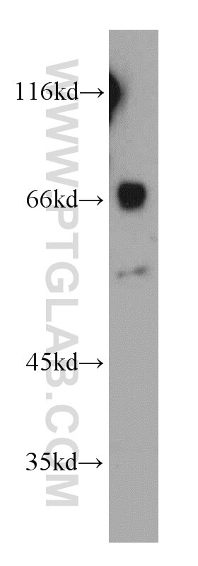 Western Blot (WB) analysis of mouse liver tissue using CCDC120 Polyclonal antibody (22041-1-AP)